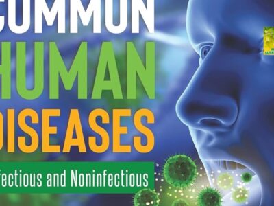 100 +COMMON DISEASES